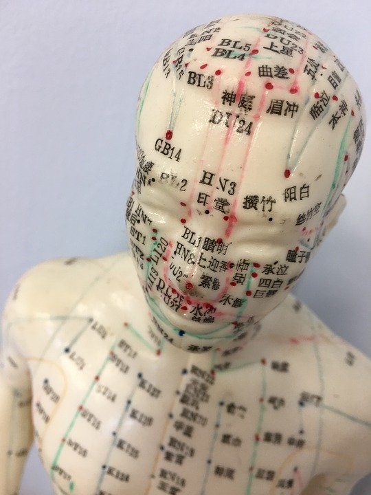 acupuncture